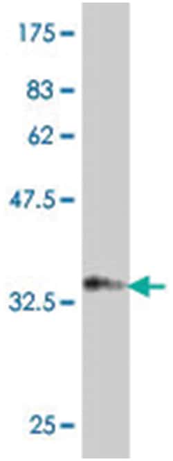 SORCS2, Mouse, Polyclonal Antibody, Abnova&trade;