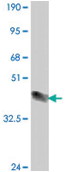 SEMA6A, Mouse, Polyclonal Antibody, Abnova™