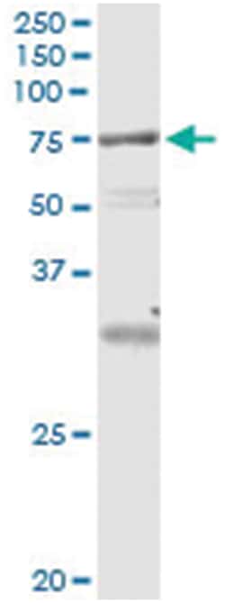 anti-VPS18, Human, IP-WB Antibody Pair, Abnova&trade;