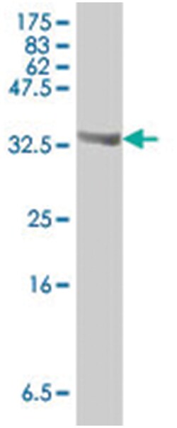 CHD8, Mouse, Polyclonal Antibody, Abnova 50&mu;L; Unlabeled:Antibodies,
