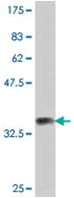 SEMA4G, Mouse, Polyclonal Antibody, Abnova 50&mu;L; Unlabeled:Antibodies,