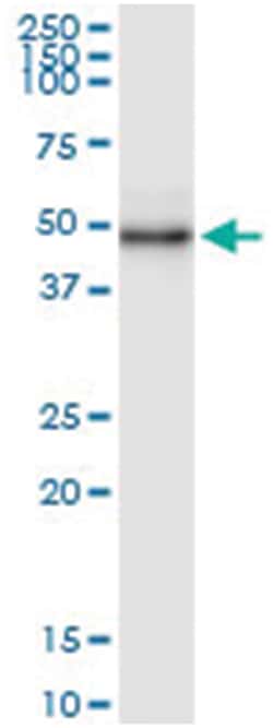 anti-WDR19, Human, IP-WB Antibody Pair, Abnova 1 Set:Antibodies, Monoclonal/Polyclonal