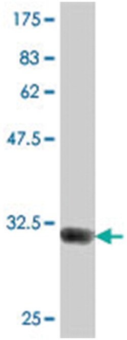 GBA3, Mouse, Polyclonal Antibody, Abnova 50 &mu;L | Buy Online | Abnova Corporation | Fisher Scientific