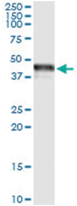 anti-TRIB3, Human, IP-WB Antibody Pair, Abnova 1 Set:Antibodies, Monoclonal/Polyclonal