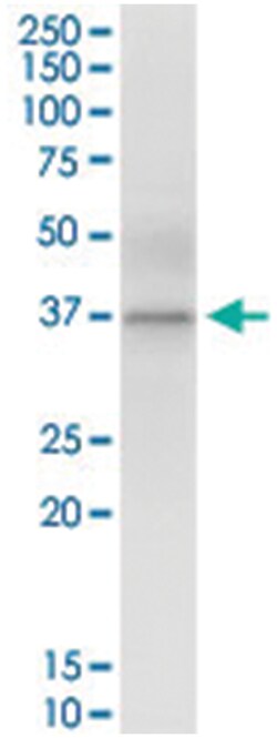 anti-ANKRA2, Human, IP-WB Antibody Pair, Abnova&trade;