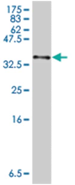 HAMP, Mouse, Polyclonal Antibody, Abnova 50&mu;L; Unlabeled:Antibodies,