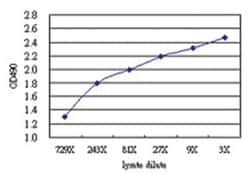 anti-ZNF71 Matched Antibody Pair, Abnova&trade;