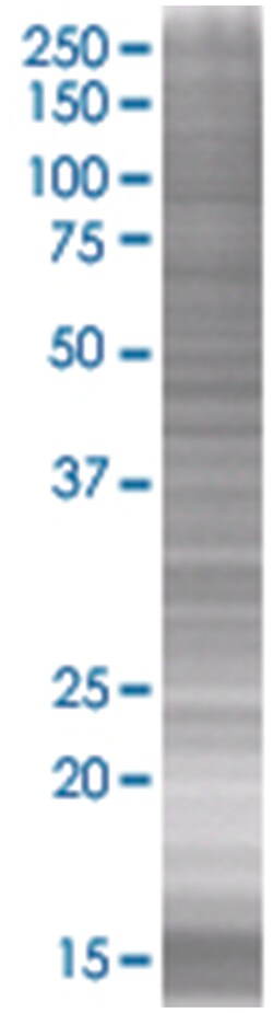 CACNG7 293T Cell Overexpression Lysate (Denatured), Abnova 100 &mu;L | Buy Online | Abnova | Fisher Scientific