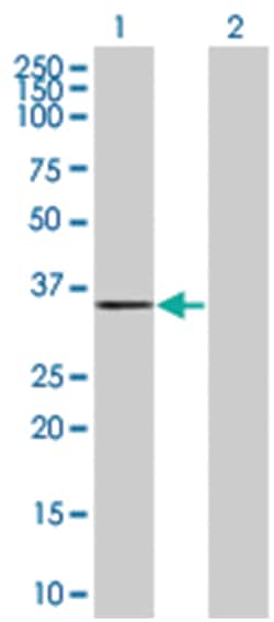 CACNG7 293T Cell Overexpression Lysate (Denatured), Abnova 100 &mu;L | Buy Online | Abnova | Fisher Scientific