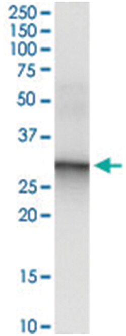 anti-CACNG6, Human, IP-WB Antibody Pair, Abnova 1 Set:Antibodies, Monoclonal/Polyclonal