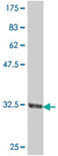 UBL5, Mouse, Polyclonal Antibody, Abnova 50 &mu;L | Buy Online | Abnova | Fisher Scientific
