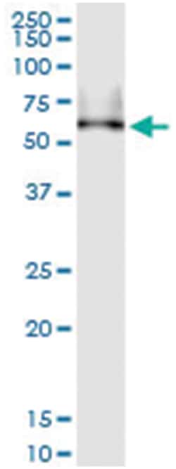 anti-SIGIRR, Human, IP-WB Antibody Pair, Abnova&trade;