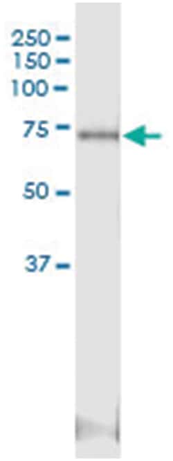anti-ALOXE3, Human, IP-WB Antibody Pair, Abnova™