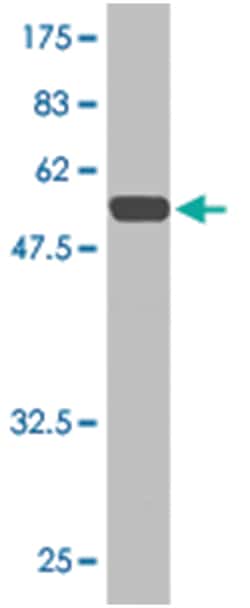 TGIF2, Mouse, Clone: 3G8, Abnova 200&mu;L; Unlabeled:Antibodies, Monoclonal