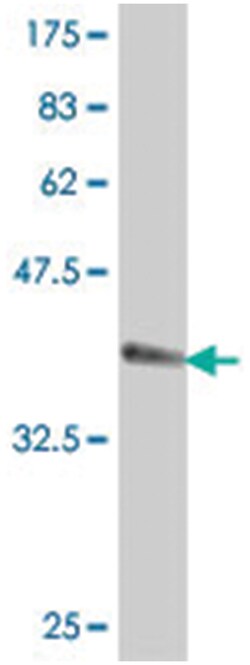 HAPLN2, Mouse, Polyclonal Antibody, Abnova 50&mu;L; Unlabeled:Antibodies,