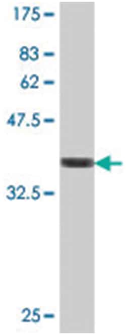SAV1, Mouse, Polyclonal Antibody, Abnova 50&mu;L; Unlabeled:Antibodies,
