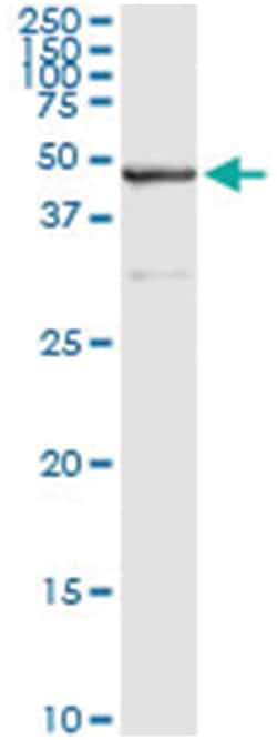 SAV1, Human, IP-WB Antibody Pair (PW2), Abnova&trade;