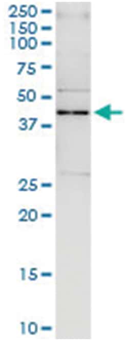 SAV1, Human, IP-WB Antibody Pair (PW3), Abnova&trade;