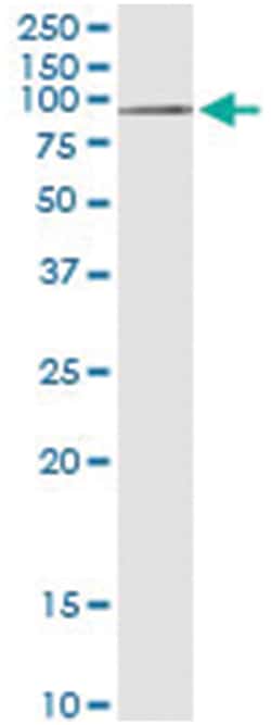 anti-AGBL5, Human, IP-WB Antibody Pair, Abnova&trade;