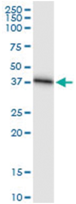 anti-SRR, Human, IP-WB Antibody Pair, Abnova&trade;