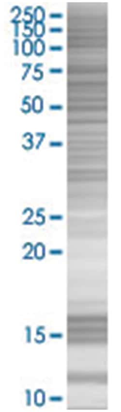 PKNOX2 293T Cell Overexpression Lysate (Denatured), Abnova 100 &mu;L | Buy Online | Abnova | Fisher Scientific