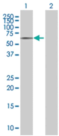 PKNOX2 293T Cell Overexpression Lysate (Denatured), Abnova 100 &mu;L | Buy Online | Abnova | Fisher Scientific