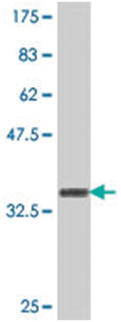 RNF123, Mouse, Polyclonal Antibody, Abnova 50 &mu;L | Buy Online | Abnova Corporation | Fisher Scientific