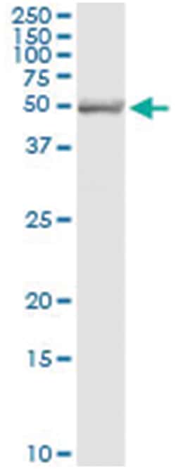 anti-SH2D4A, Human, IP-WB Antibody Pair, Abnova 1 Set:Antibodies, Monoclonal/Polyclonal