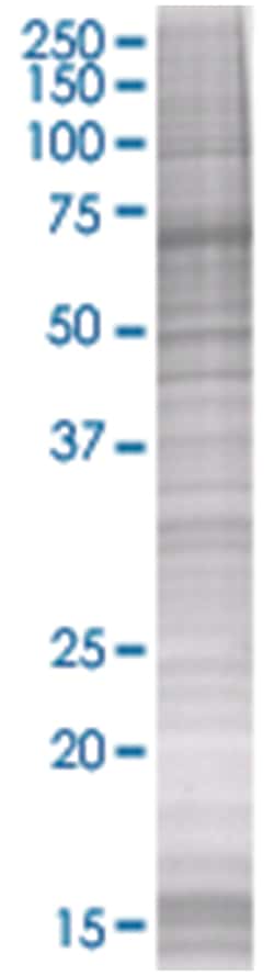 CIDEC 293T Cell Overexpression Lysate 2 (Denatured), Abnova 100 &mu;L | Buy Online | Abnova | Fisher Scientific
