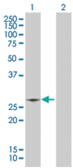 CIDEC 293T Cell Overexpression Lysate 2 (Denatured), Abnova 100 &mu;L | Buy Online | Abnova | Fisher Scientific