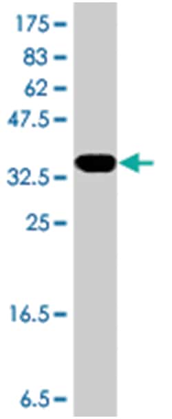 P53AIP1, Mouse, Polyclonal Antibody, Abnova 50&mu;L; Unlabeled:Antibodies,