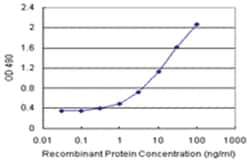 anti-PARVG Matched Antibody Pair, Abnova