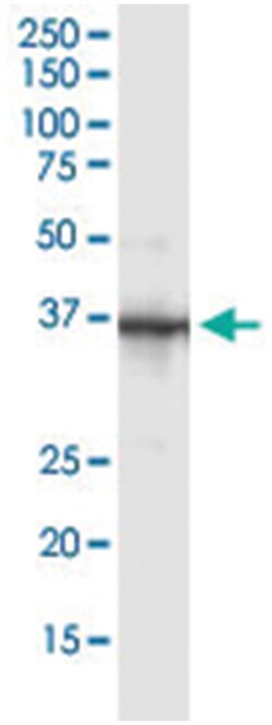 PARVG, Human, IP-WB Antibody Pair (PW2), Abnova&trade;