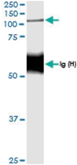 anti-NOD2, Human, IP-WB Antibody Pair, Abnova&trade;