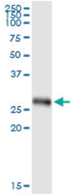 anti-IFIH1, Human, IP-WB Antibody Pair, Abnova&trade;