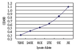 anti-LEPRE1 Matched Antibody Pair, Abnova 1 set, Unlabeled:Antibodies,