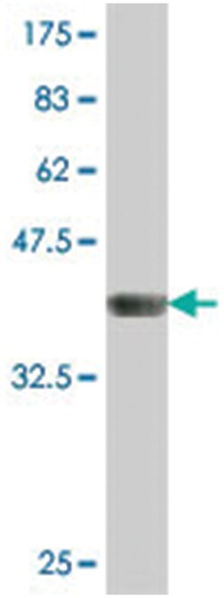 LHX5, Mouse, Polyclonal Antibody, Abnova 50&mu;L; Unlabeled:Antibodies,