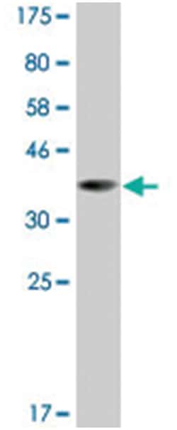 LHX5, Mouse, Clone: 1D9, Abnova 200&mu;L; Unlabeled:Antibodies, Monoclonal