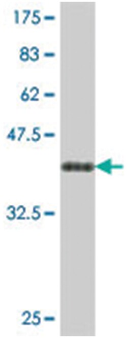 TOR3A, Mouse, Polyclonal Antibody, Abnova 50&mu;L; Unlabeled:Antibodies,