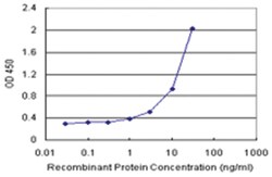 anti-RAB17 Matched Antibody Pair, Abnova
