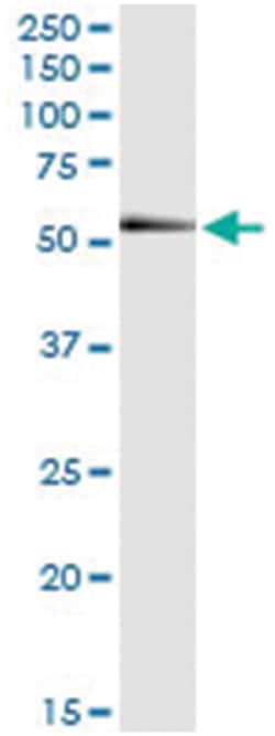 anti-RNF25, Human, IP-WB Antibody Pair, Abnova&trade;