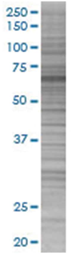 ZNFN1A4 293T Cell Overexpression Lysate (Denatured), Abnova 100 &mu;L | Buy Online | Abnova | Fisher Scientific