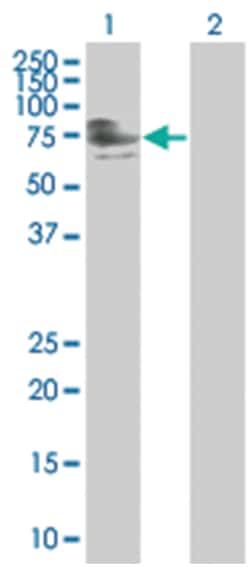 ZNFN1A4 293T Cell Overexpression Lysate (Denatured), Abnova 100 &mu;L | Buy Online | Abnova | Fisher Scientific