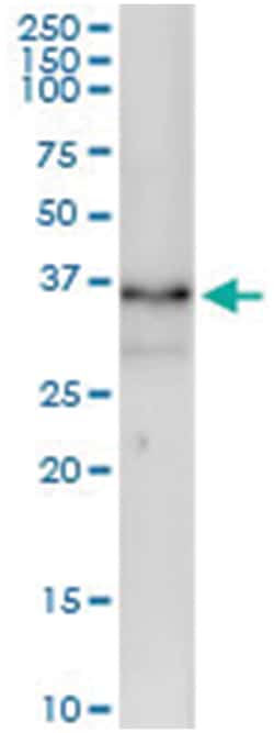anti-ZMAT3, Human, IP-WB Antibody Pair, Abnova 1 Set | Buy Online | Abnova Corporation | Fisher Scientific