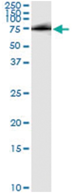 anti-HHIP, Human, IP-WB Antibody Pair, Abnova&trade;