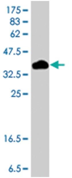 CDH22, Mouse, Polyclonal Antibody, Abnova 50&mu;L; Unlabeled:Antibodies,