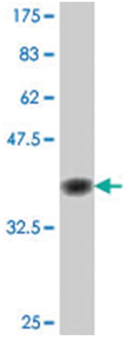 APG3L, Mouse, Polyclonal Antibody, Abnova 50 &mu;L | Buy Online | Abnova Corporation | Fisher Scientific