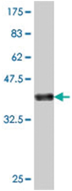 NDST4, Mouse, Polyclonal Antibody, Abnova 50&mu;L; Unlabeled:Anticuerpos