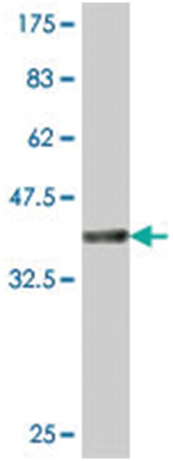 IPPK, Mouse, Polyclonal Antibody, Abnova 50&mu;L; Unlabeled:Antibodies,