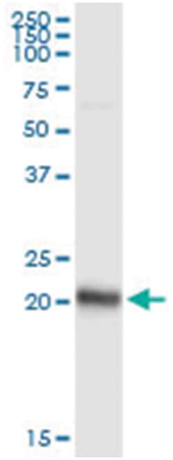 anti-FNDC4, Human, IP-WB Antibody Pair, Abnova&trade;